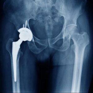 hip