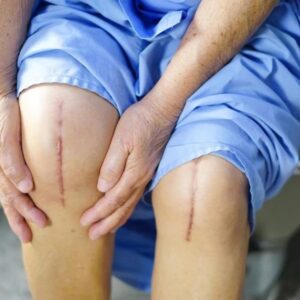 knee